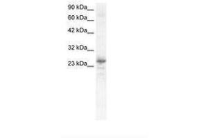 Image no. 1 for anti-NK2 Homeobox 8 (NKX2-8) (C-Term) antibody (ABIN6735828) (NKX2-8 antibody  (C-Term))
