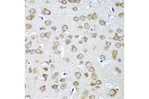 Immunohistochemistry of paraffin-embedded mouse brain using EIF1AX antibody at dilution of 1:100 (40x lens). (EIF1AX antibody)