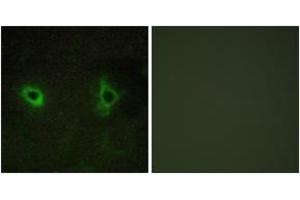 Immunofluorescence analysis of COS7 cells, using Collagen IV alpha3 Antibody. (COL4a3 antibody  (AA 801-850))