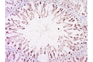 Paraformaldehyde-fixed, paraffin embedded rat testis, Antigen retrieval by boiling in sodium citrate buffer (pH6) for 15min, Block endogenous peroxidase by 3% hydrogen peroxide for 30 minutes, Blocking buffer (normal goat serum) at 37°C for 20min, Antibody incubation with Rabbit Anti-CCDC98 Polyclonal Antibody, Unconjugated  at 1:500 overnight at 4°C, followed by a conjugated secondary for 90 minutes and DAB staining. (CCDC98 antibody  (AA 51-150))