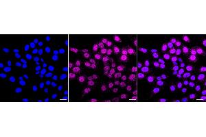 Immunocytochemical staining of HepG2 cells with Annexin A7 antibody (ABIN7797626), 1:1,000). (Recombinant Annexin VII antibody)