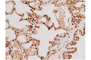 ABIN6267502 at 1/200 staining Rat lung tissue sections by IHC-P. (STAT3 antibody  (pTyr705))