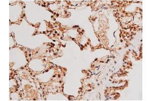 ABIN6267502 at 1/200 staining Rat lung tissue sections by IHC-P. (STAT3 antibody  (pTyr705))