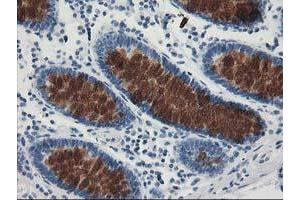 Immunohistochemical staining of paraffin-embedded Human colon tissue using anti-AP2M1 mouse monoclonal antibody. (AP2M1 antibody  (AA 97-383))