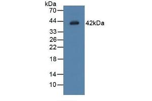 Detection of LGMN in Rat Placenta Tissue using Polyclonal Antibody to Legumain (LGMN) (LGMN antibody  (AA 18-433))