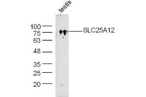 Mouse testis lysate probed with Rabbit Anti-SLC25A12/ARALAR Polyclonal Antibody, Unconjugated  at 1:300 overnight at 4˚C. (SLC25A12 antibody  (AA 101-200))