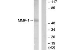 Western blot analysis of extracts from HepG2 cells, using MMP-1 Antibody. (MMP1 antibody  (AA 411-460))