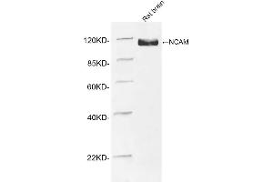 Western blot analysis of tissue lysates using 1 µg/mL Rabbit Anti-NCAM Polyclonal Antibody (ABIN398893) The signal was developed with IRDyeTM 800 Conjugated Goat Anti-Rabbit IgG.