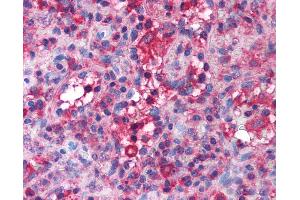 Anti-Band 3 antibody IHC of human spleen. (Band 3/AE1 antibody  (AA 184-233))