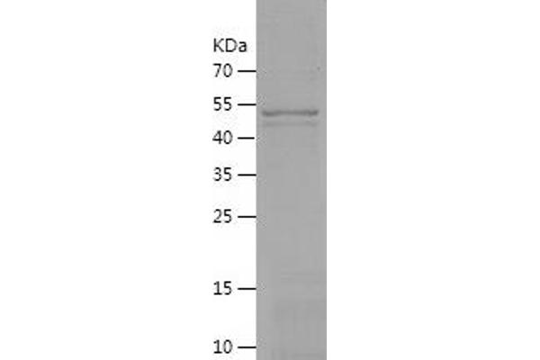 TNFAIP6 Protein (AA 18-277) (His-IF2DI Tag)