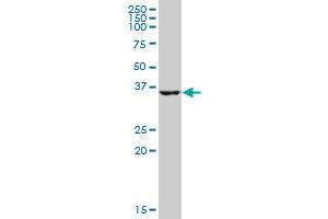 HSD17B2 MaxPab polyclonal antibody. (HSD17B2 antibody  (AA 1-387))