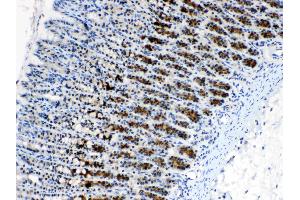 IHC analysis of CD166/ALCAM using anti- CD166/ALCAM antibody . (CD166 antibody  (AA 167-406))