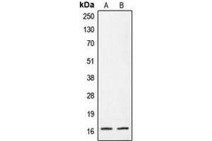 Western blot analysis of CRABP2 expression in A431 (A), HeLa (B) whole cell lysates. (CRABP2 antibody  (Center))