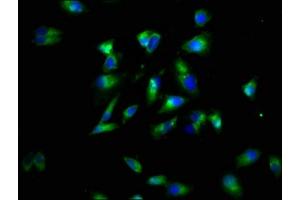 Immunofluorescence staining of Hela cells with ABIN7173883 at 1:60, counter-stained with DAPI. (LTBR antibody  (AA 31-224))