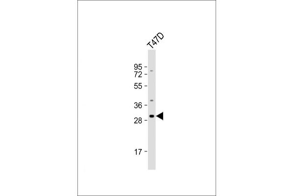 OR10T2 Antikörper  (C-Term)
