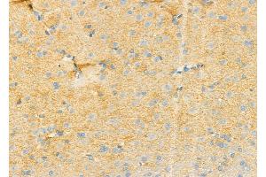 ABIN6258722 and ABIN6274757 at 1/100 staining Rat brain tissue by IHC-P.