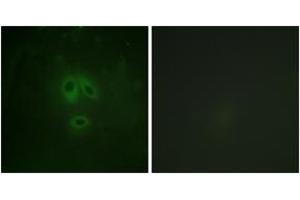 Immunofluorescence analysis of HeLa cells, using n-NOS (Phospho-Ser852) Antibody. (NOS1 antibody  (pSer852))