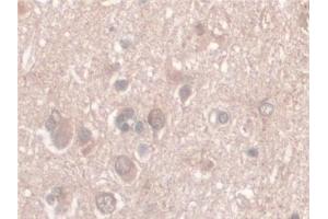 Detection of Nesp2 in Human Cerebrum Tissue using Polyclonal Antibody to Nesprin 2 (Nesp2) (SYNE2 antibody  (AA 6-296))