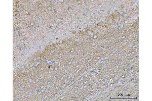 IHC analysis of YWHAE using anti-YWHAE antibody (ABIN7600163). (YWHAE antibody  (AA 16-163))