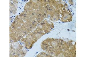 Immunohistochemistry of paraffin-embedded Human stomach using FLT3 Polyclonal Antibody (FLT3 antibody)