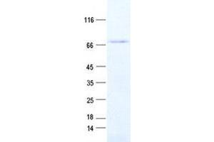 Validation with Western Blot (ZNHIT6 Protein (His tag))