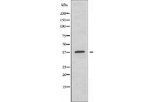 Western blot analysis of extracts from COLO cells, using ABHD6 antibody. (ABHD6 antibody  (Internal Region))