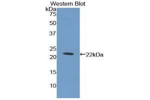 Western Blotting (WB) image for anti-Myeloproliferative Leukemia Virus Oncogene (MPL) (AA 311-460) antibody (ABIN3206605)