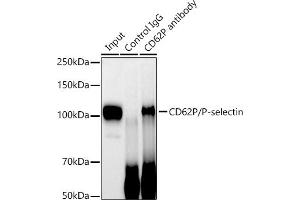 Immunoprecipitation analysis of 600 μg extracts of Mouse spleen cells using 3 μg CD62P/P-selectin antibody (ABIN7270190).