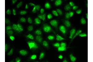 Immunofluorescence analysis of A549 cells using BIRC2 antibody. (BIRC2 antibody  (AA 1-300))