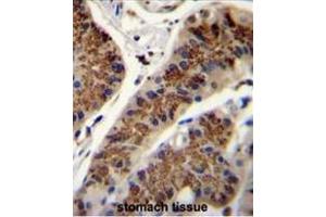 INHBA Antibody (N-term) immunohistochemistry analysis in formalin fixed and paraffin embedded human stomach tissue followed by peroxidase conjugation of the secondary antibody and DAB staining.