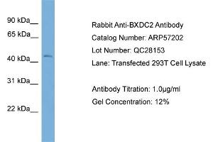 WB Suggested Anti-BXDC2  Antibody Titration: 0. (BRIX1 antibody  (Middle Region))