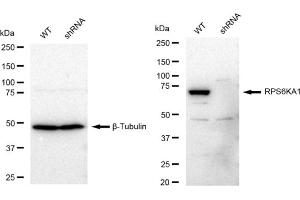 Western blotting analysis using RPS6KA1 antibody (ABIN7800229).
