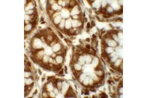 Immunohistochemical staining of human colon cells with LRRFIP2 polyclonal antibody  at 5 ug/mL. (LRRFIP2 antibody  (C-Term))