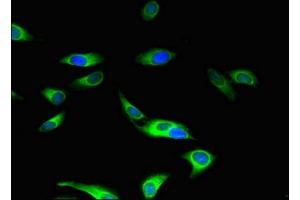 Immunofluorescent analysis of Hela cells using ABIN7160045 at dilution of 1:100 and Alexa Fluor 488-congugated AffiniPure Goat Anti-Rabbit IgG(H+L) (ASK1 antibody  (AA 363-431))