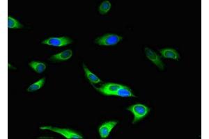 Immunofluorescent analysis of Hela cells using ABIN7160045 at dilution of 1:100 and Alexa Fluor 488-congugated AffiniPure Goat Anti-Rabbit IgG(H+L) (ASK1 antibody  (AA 363-431))