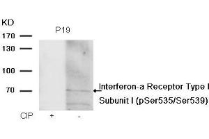 Western blot analysis of extracts from P19 cells, treated with calf intestinal phosphatase (CIP), using Interferon-a Receptor Type I Subunit I (phospho-Ser535/Ser539) Antibody. (IFNAR1 antibody  (pSer535, pSer539))