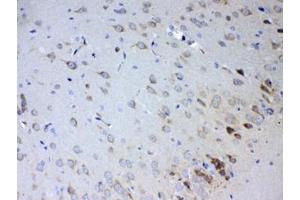 IHC testing of FFPE rat brain tissue with IL15RA antibody at 1ug/ml. (IL15RA antibody)