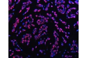 IF analysis of TRMT6 using anti-TRMT6 antibody (ABIN7602138).