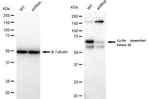 Western blotting analysis using Cyclin dependent kinase 16 antibody (ABIN7798208).