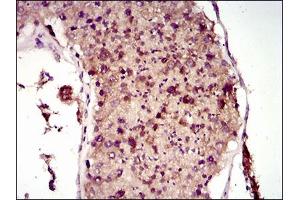 Immunohistochemical analysis of paraffin-embedded testis tissues using MAP1LC3A mouse mAb with DAB staining. (MAP1LC3A antibody  (AA 1-121))