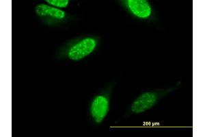 Immunofluorescence of monoclonal antibody to CARF on HeLa cell. (CDKN2AIP antibody  (AA 1-579))