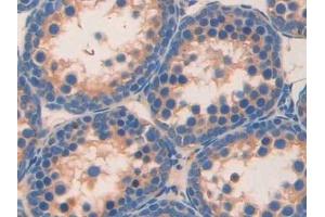 Detection of RETN in Mouse Testis Tissue using Monoclonal Antibody to Resistin (RETN) (Resistin antibody  (AA 21-114))