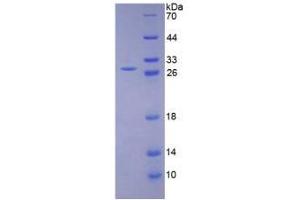SDS-PAGE analysis of Human LOXL1 Protein. (LOXL1 Protein)