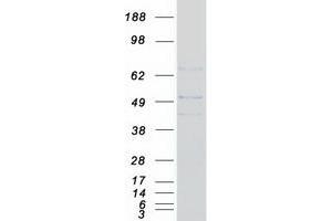 Validation with Western Blot (SLC2A6 Protein (Myc-DYKDDDDK Tag))