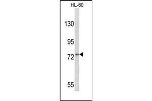 Western blot analysis of CD114 / CSF3R Antibody (Center) in HL-60 cell line lysates (35ug/lane).