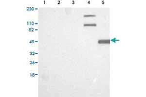 Western Blot analysis of (1) Human RT-4 cell, (2) Human U-251MG sp cell, (3) Human A-431 cell, (4) Human liver tissue, (5) Human tonsil tissue. (CAPN10 antibody)