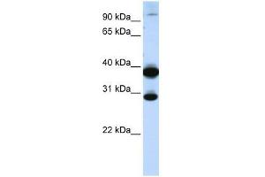 Western Blot showing ZNF138 antibody used at a concentration of 1-2 ug/ml to detect its target protein. (ZNF138 antibody  (C-Term))