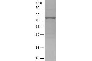 Western Blotting (WB) image for DDB1 and CUL4-Associated Factor 1 (DCAF1) (AA 1317-1507) protein (His-IF2DI Tag) (ABIN7122604) (DDB1 and CUL4-Associated Factor 1 (DCAF1) (AA 1317-1507) protein (His-IF2DI Tag))