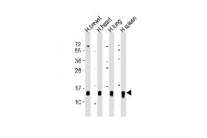 All lanes : Anti-S100A9 Antibody (Center) at 1:500-1:1000 dilution Lane 1: human breast lysate Lane 2: human heart lysate Lane 3: human lung lysate Lane 4: human spleen lysate Lysates/proteins at 20 μg per lane. (S100A9 antibody  (AA 22-56))