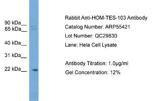 WB Suggested Anti-HOM-TES-103  Antibody Titration: 0. (IFFO1 antibody  (C-Term))